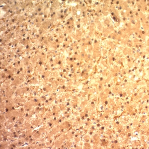 Arginase 1 (Hepatocellular Carcinoma Marker); Clone ARG1/1125 (Concentrate)